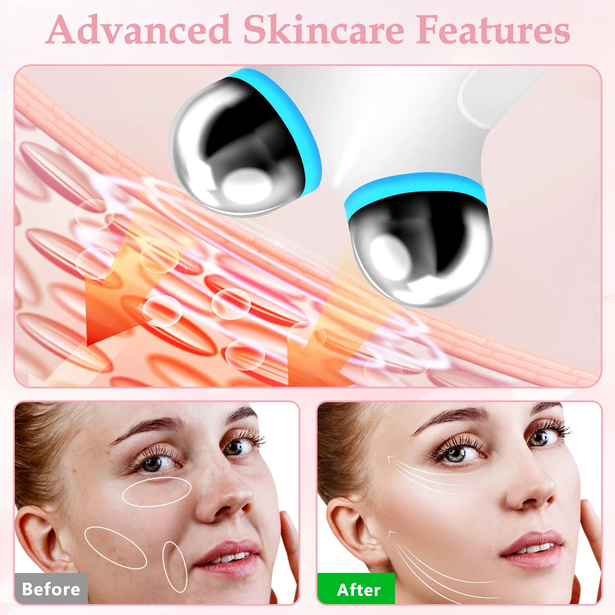 Microcurrent Facial Lifting Device