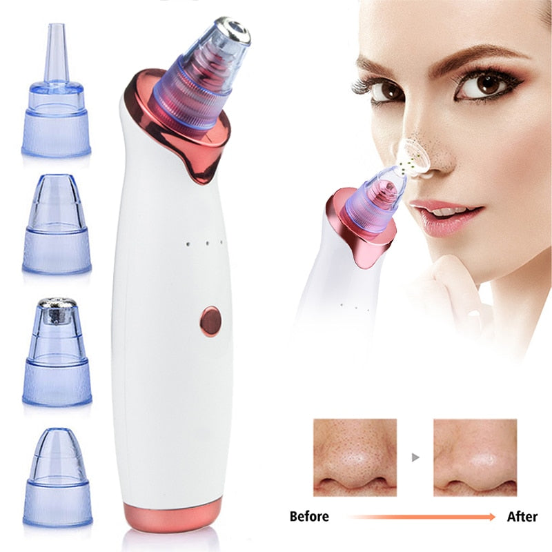 Electric Blackhead Remover Vacuum